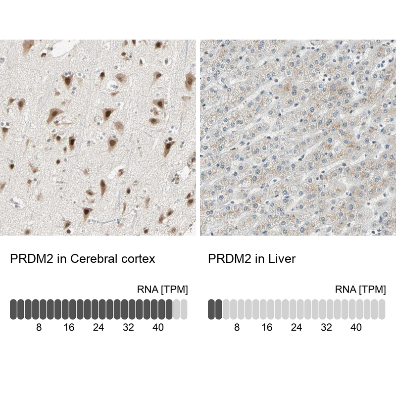 Anti-PRDM2 Antibody