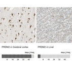 Anti-PRDM2 Antibody