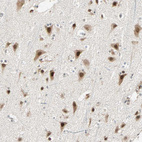 Immunohistochemical staining of human cerebral cortex shows strong nuclear and cytoplasmic positivity in neurons.