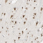 Immunohistochemical staining of human cerebral cortex shows strong nuclear and cytoplasmic positivity in neurons.