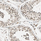 Immunohistochemical staining of human testis shows moderate nuclear positivity in cells in seminiferous ducts.