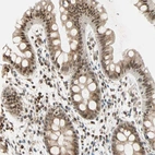 Immunohistochemical staining of human rectum shows moderate nuclear positivity in glandular cells.