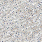 Anti-PRDM2 Antibody