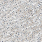 Immunohistochemical staining of human liver shows very weak positivity in hepatocytes.