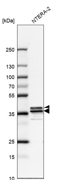 Anti-HNRNPA2B1 Antibody