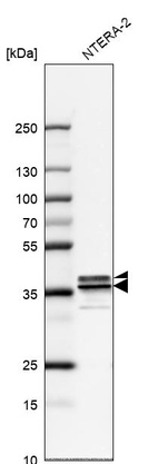 Anti-HNRNPA2B1 Antibody