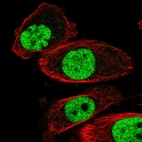 Immunofluorescent staining of human cell line PC-3 shows localization to nucleoplasm.