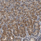 Anti-ARMT1 Antibody