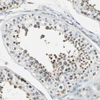 Immunohistochemical staining of human testis shows strong cytoplasmic positivity in cells in seminiferous ducts.