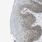 Immunohistochemical staining of human skin shows moderate cytoplasmic positivity in squamous epithelial cells.
