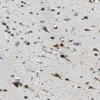 Immunohistochemical staining of human cerebral cortex shows strong cytoplasmic positivity in neuronal cells.