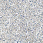 Anti-USP40 Antibody