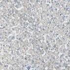 Immunohistochemical staining of human liver shows weak cytoplasmic positivity in hepatocytes as expected.
