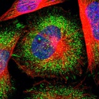 Immunofluorescent staining of human cell line U-251 MG shows localization to focal adhesion sites & vesicles.