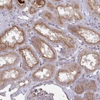 Anti-IL1R1 Antibody