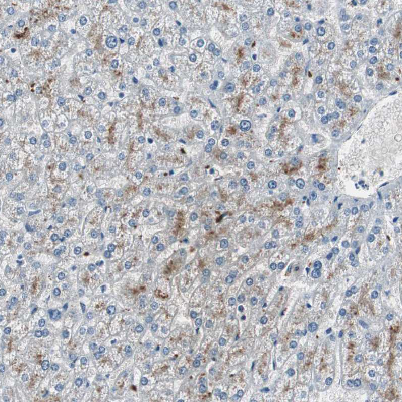 Anti-SERPINF1 Antibody
