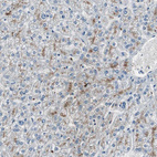 Anti-SERPINF1 Antibody