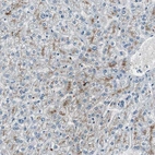 Anti-SERPINF1 Antibody
