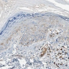Immunohistochemical staining of human skin shows moderate cytoplasmic positivity in squamous epithelial cells.