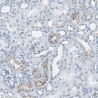 Immunohistochemical staining of human kidney shows moderate to strong cytoplasmic granular positivity in a subset of cells in tubules