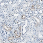 Immunohistochemical staining of human kidney shows moderate to strong cytoplasmic granular positivity in a subset of cells in tubules