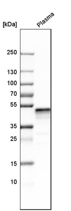 Western blot analysis in human plasma.