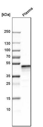 Western blot analysis in human plasma.