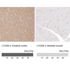 Anti-L1CAM Antibody