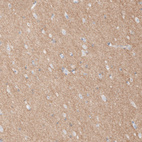 Immunohistochemical staining of human cerebral cortex shows moderate cytoplasmic positivity in neuropil.