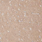 Anti-L1CAM Antibody