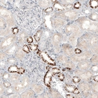 Immunohistochemical staining of human kidney shows moderate membranous positivity in cells in distal tubules.