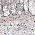 Anti-L1CAM Antibody