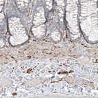 Immunohistochemical staining of human colon shows moderate positivity in peripheral nerve / ganglion.