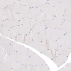 Anti-L1CAM Antibody