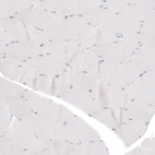 Immunohistochemical staining of human skeletal muscle shows no positivity in myocytes as expected.