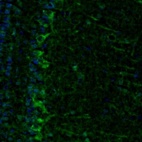 Anti-ECH1 Antibody