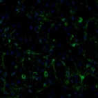 Immunofluorescence staining of mouse caudate putamen shows positivity in neurons and blood vessels.