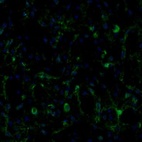 Anti-ECH1 Antibody