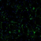 Immunofluorescence staining of mouse caudate putamen shows positivity in neurons and blood vessels.