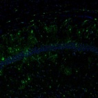 Anti-ECH1 Antibody