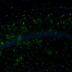 Immunofluorescence staining of mouse hippocampus shows immunoreactivity in the CA1 region.