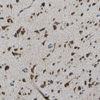 Anti-ECH1 Antibody