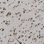 Immunohistochemical staining of human cerebral cortex shows strong cytoplasmic immunoreactivity in neurons.