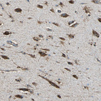 Immunohistochemical staining of human hippocampus shows strong cytoplasmic positivity in neuronal cell bodies.