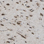 Immunohistochemical staining of human hippocampus shows strong cytoplasmic positivity in neuronal cell bodies.