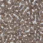 Immunohistochemical staining of human liver shows strong cytoplasmic positivity in a granular pattern in hepatocytes.