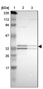Lane 1: Marker [kDa] 220, 112, 84, 47, 32, 26, 17_br/_Lane 2: Human cell line RT-4_br/_Lane 3: Human cell line U-251MG sp