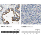 Anti-RASD2 Antibody