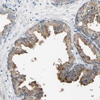 Anti-RASD2 Antibody