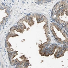 Immunohistochemical staining of human prostate shows high expression.